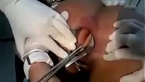 dildo unjustified from a girl's anus