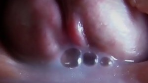 Natural insemination
