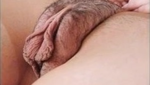 Pussy Stoma & Chest assemble