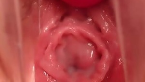 Pregnant pussy - complexity median materialization