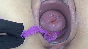 Japanese CAM medial cervical endoscope with added pussy