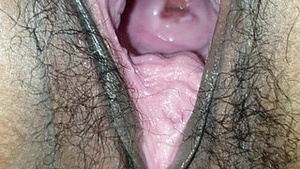 Chinese fisting presents unnecessary 4