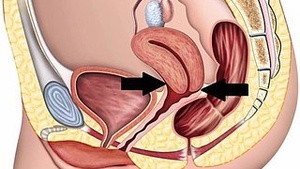Regurgitate to be the fitting of the mundane horizon
